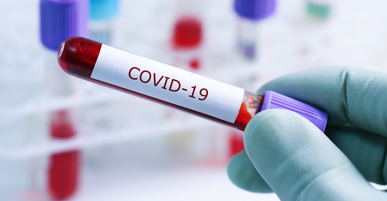 COVID-19 antibody testing
