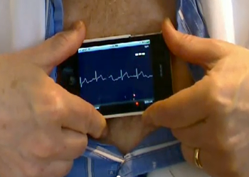 AliveCor2.png