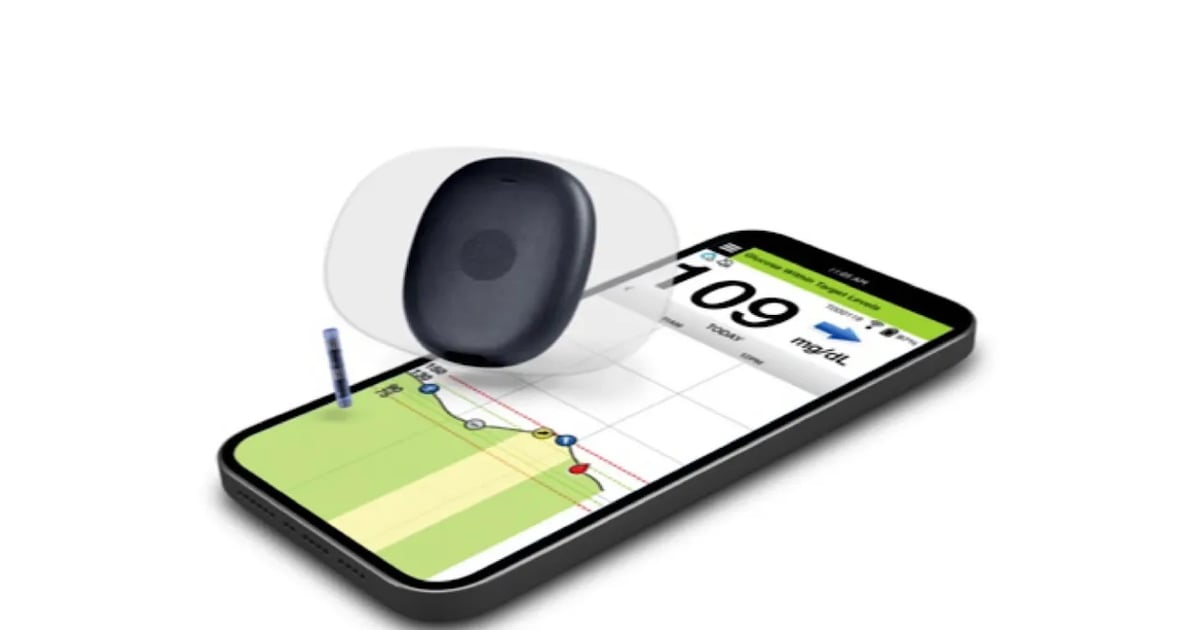 Senseonics Reports 150% Revenue Surge on Direct Distribution Move