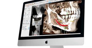 new dental tech spin out to offer Invivo 3D dental tech software