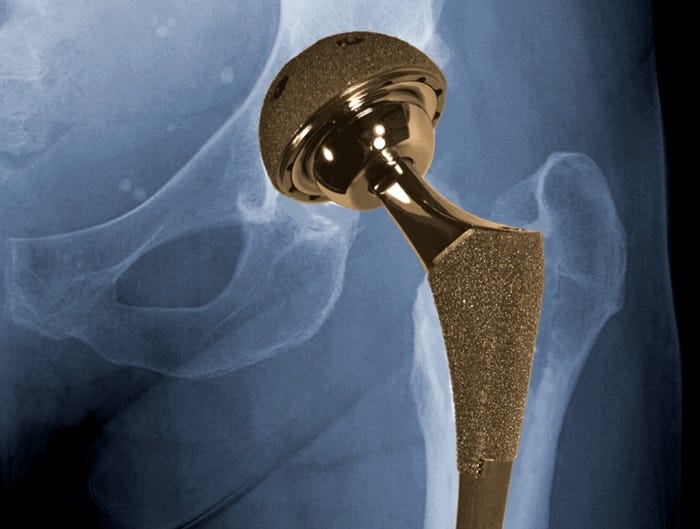 Biomet hip implant