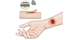 drawing of smart bandage on arm