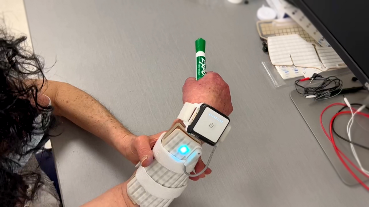 medical device on a patient's wrist