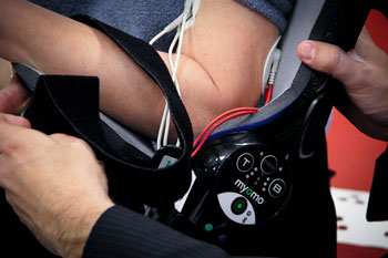Bionic Arm Offers Hope to Stroke Patients