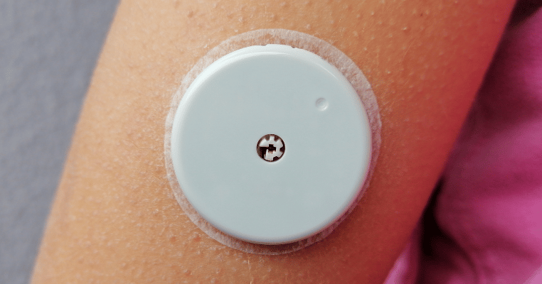 Innovation in Patient Monitoring and Wearables