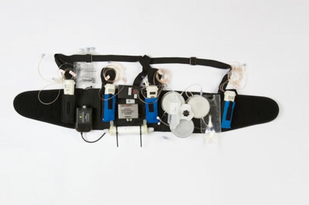 Wearable Artificial Kidney Could be Game Changer