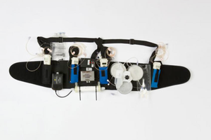 Wearable Artificial Kidney Could be Game Changer