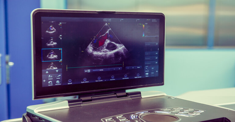heart ultrasound (1).jpg