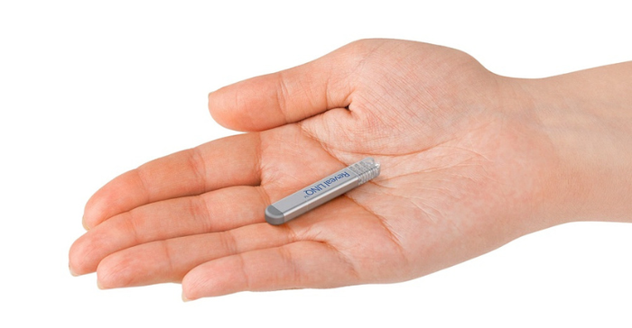 Photo of a Medtronic Reveal LINQ implantable cardiac monitor in the palm of someone's hand. The device is designed to detect atrial fibrillation and other heart rhythm abnormalities.