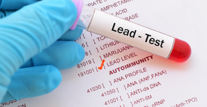 Lead test blood test