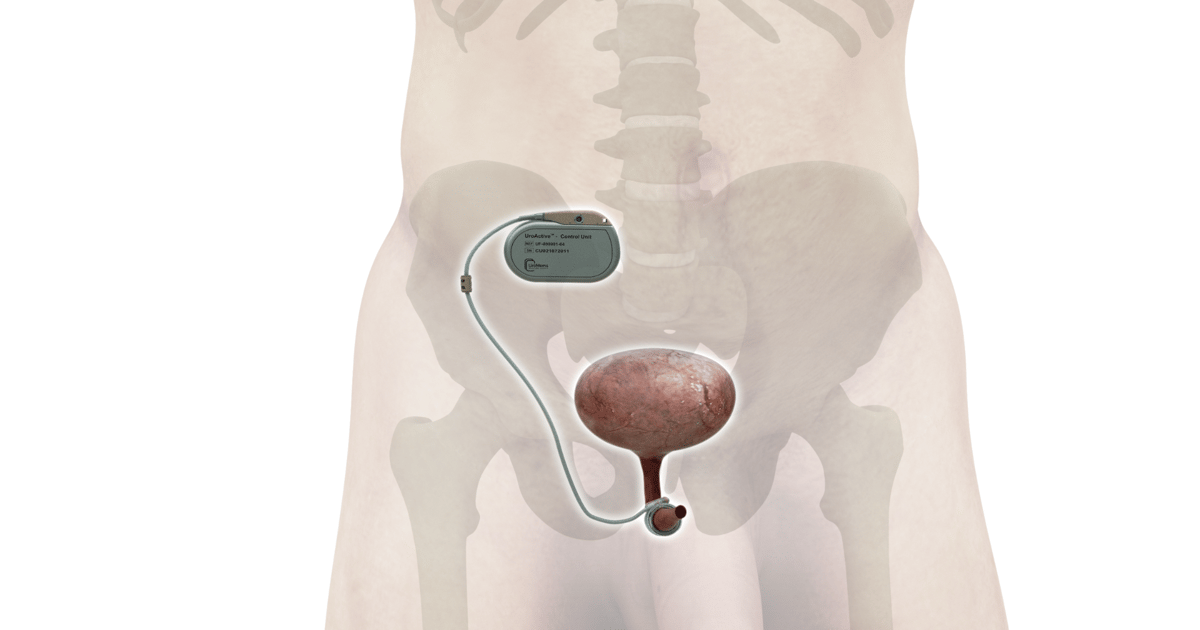UroMems Tackles Stress Urinary Incontinence in Men