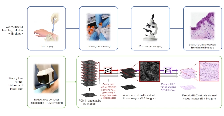 Can This New Tech Reduce the Need for Skin Biopsies?