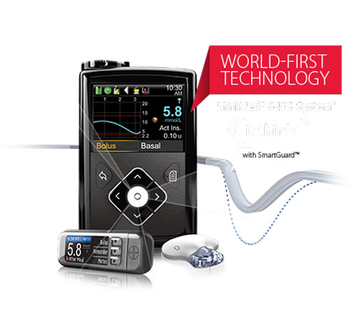10 Hot Devices We Can't Get in the U.S.—Medtronic's MiniMed 640G