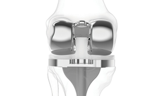 ConforMIS' CEO Believes Robotics Is Not the Answer in Orthopedics
