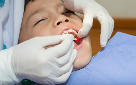 FDA Stands By Its Dental Amalgam Mistake