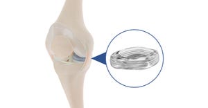 NUsurface Implant in Knee Call-Out_online.jpg