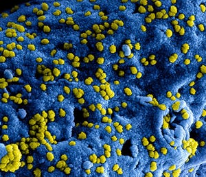 FDA Lays Out Plan for Coronavirus Medical Countermeasures
