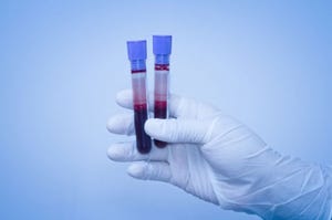 Blood Test Cuts Costs and Speeds IBS Diagnosis