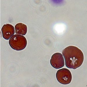 Red blod cells carrying drugs.