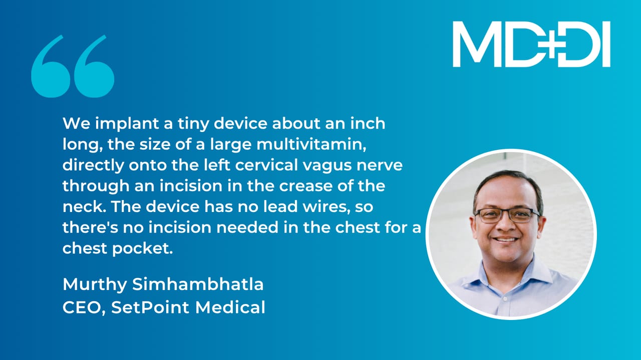 SetPoint's Miniature Implant Offers New Hope for Rheumatoid Arthritis ...