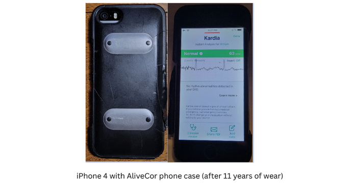 iPhone 4 with AliveCor EKG phone case after 11 years of wear.