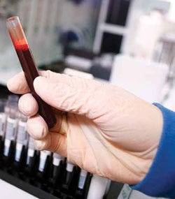 A small number of companies are working to disrupt the blood testing industry. Image from Wikipedia.  