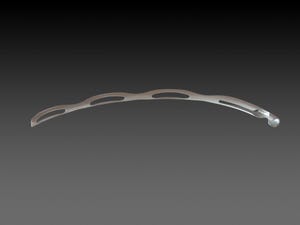 Ivantis Now Has Its MIGS Stent Approved