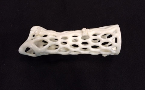 6 Devices That Show 3-D Printing's Potential in Medtech