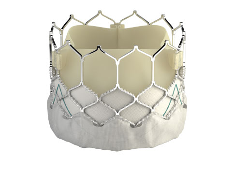 Edwards Sapien 3 TAVR Approved Earlier than Expected