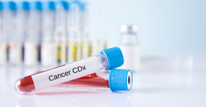 vials of blood samples with label: cancer CDx