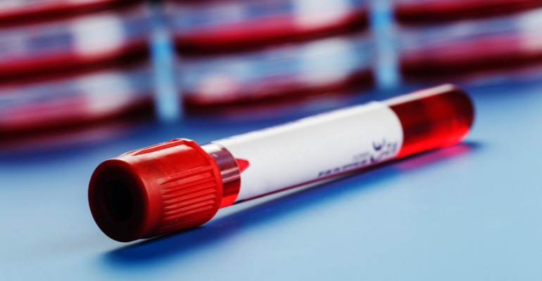 blood test - cancer test - research