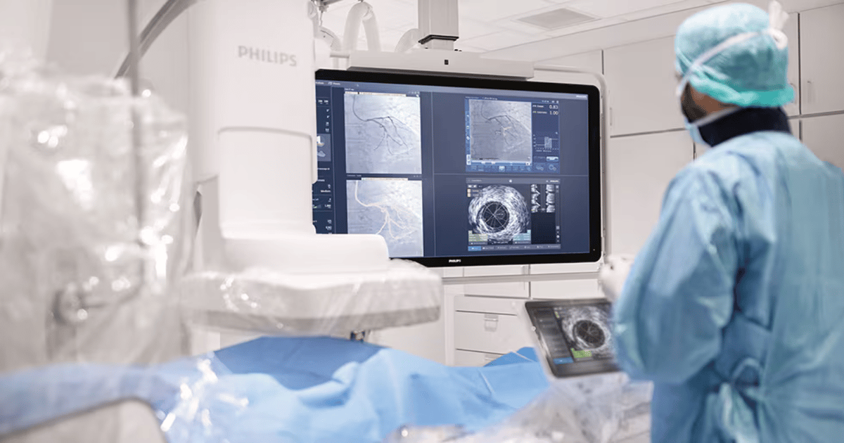 Philips Grabs AI Imaging Firm SpectraWave