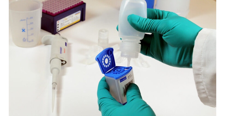 Disposable stool sampling kit: includes a sample collection device, buffer and multi-stage filtration cap to directly