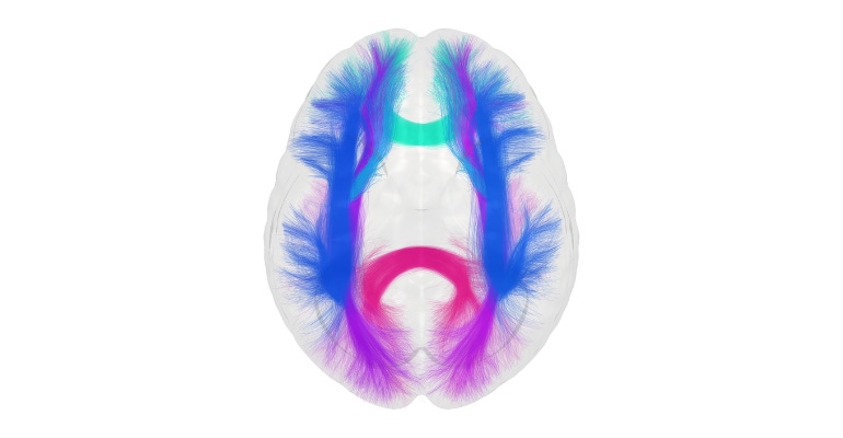 brain imaging technology developed by Imeka