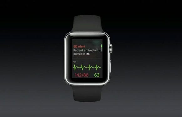 Apple Watch with AirStrip One