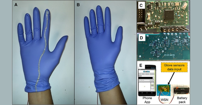 surgical gloves designed with sensors to detect fetal position and other factors critical to preventing obstructed delivery and stillbirth are shown in this photo, along with images of the embedded technology.