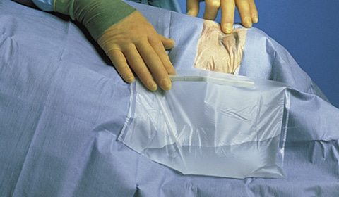 Tapes and Drapes: Adhesives and Materials in Surgical Supplies