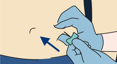 insert needle