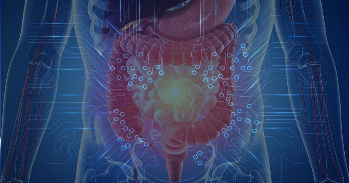 Before the clinical trial: A computational approach to microbiome-targeted formulations