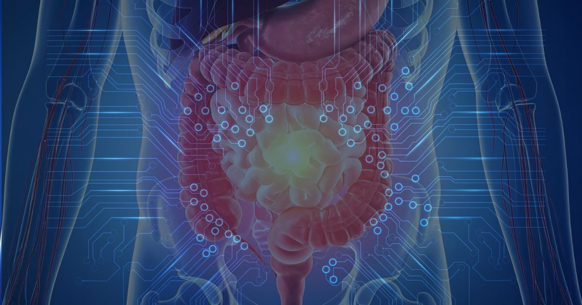 Before the clinical trial: A computational approach to microbiome-targeted formulations
