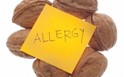 Understanding Food Allergies Understanding Food Allergies