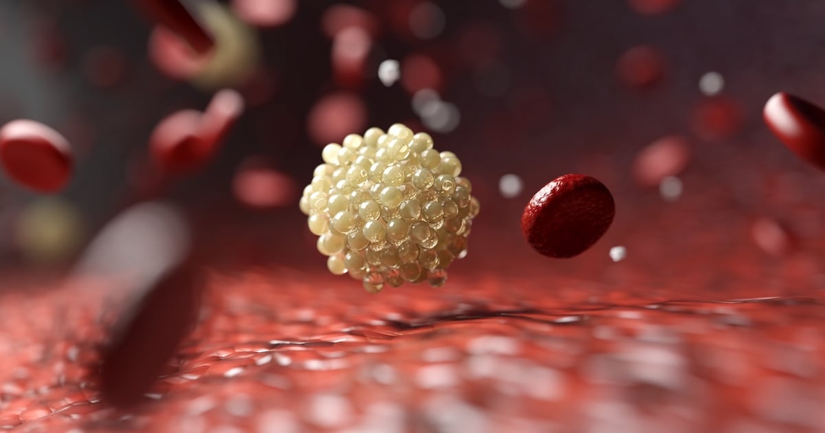 Fatty acids predict disease before symptoms show Fatty acids predict disease before symptoms show