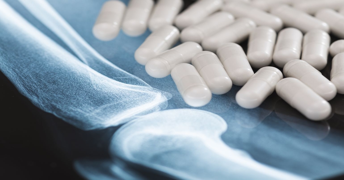 Bone and joint health dietary supplement sales