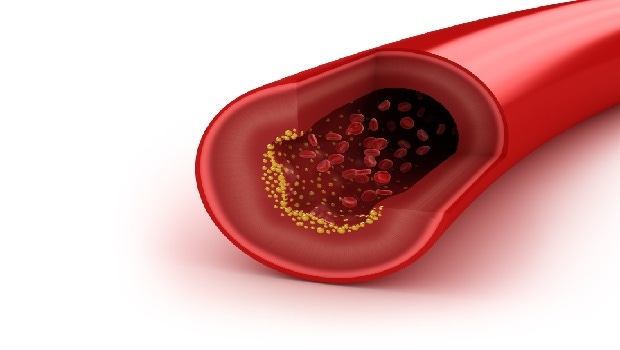 Natural Products for Cholesterol Management