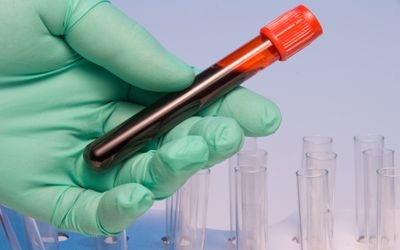 DPA: An Up-and-Coming Fatty Acid DPA: An Up-and-Coming Fatty Acid