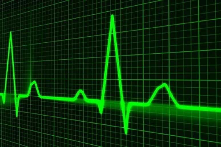 Skype for Business – Death Exaggerated, but on Life Support