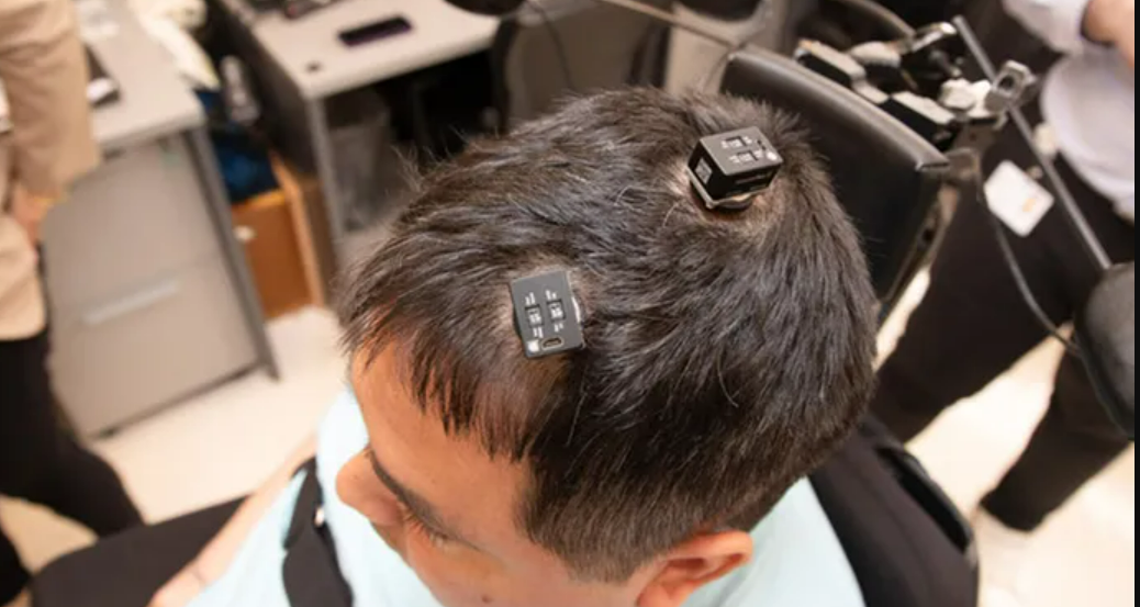 Pioneering Surgery Uses AI to Help Quadriplegic Move, Feel