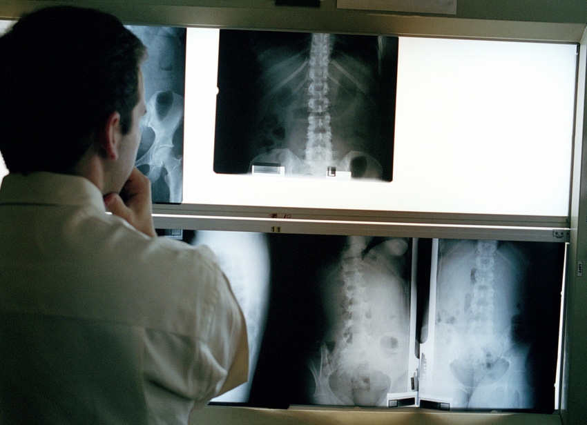 A stock photo of a doctor looking at x-rays on lightboxes.