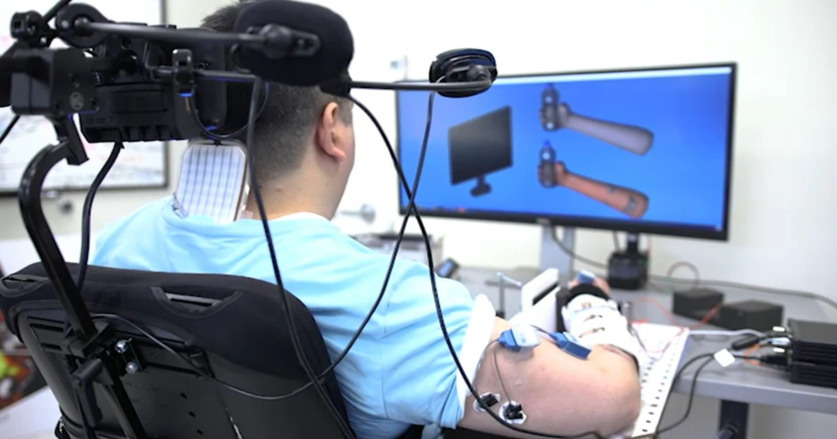 Pioneering Surgery Uses AI to Help Quadriplegic Move, Feel