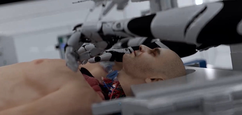 A still from BrainBridge's CGI video of the possible head transplant